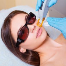 Laser Skin Rejuvenation