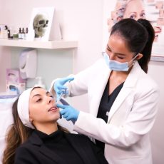 dermal filler melbourne